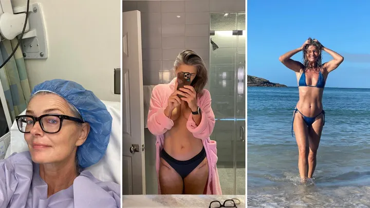Paulina Porizkova revela cicatrizes profundas de cirurgia em fotos atrevidas após ser hospitalizada para substituição dupla do quadril